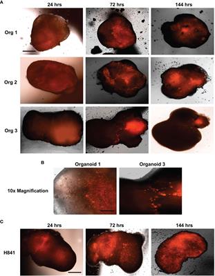 Organoids as a Systems Platform for SCLC Brain Metastasis